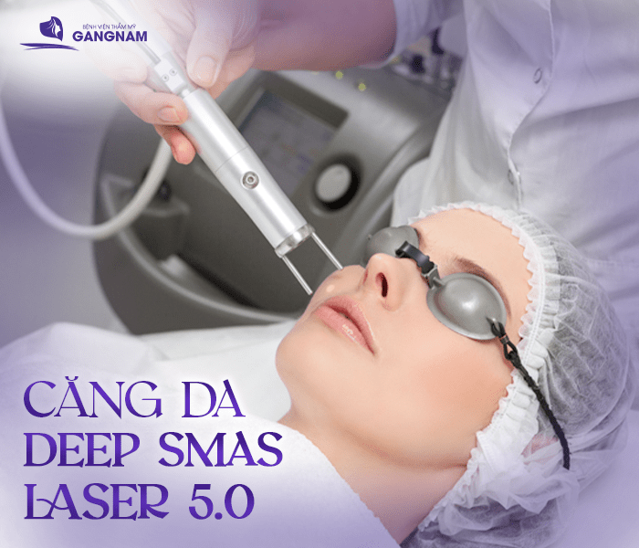 hình ảnh Căng Da Mặt Deep Smas Laser 5.0 – Tương Lai Của Căng Da Mặt Không Phẫu Thuật