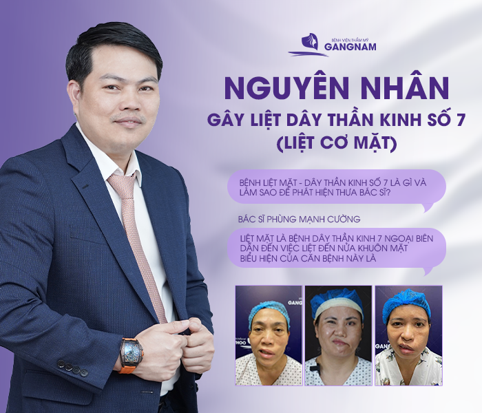 hình ảnh Các nguyên nhân gây ra liệt dây thần kinh số 7