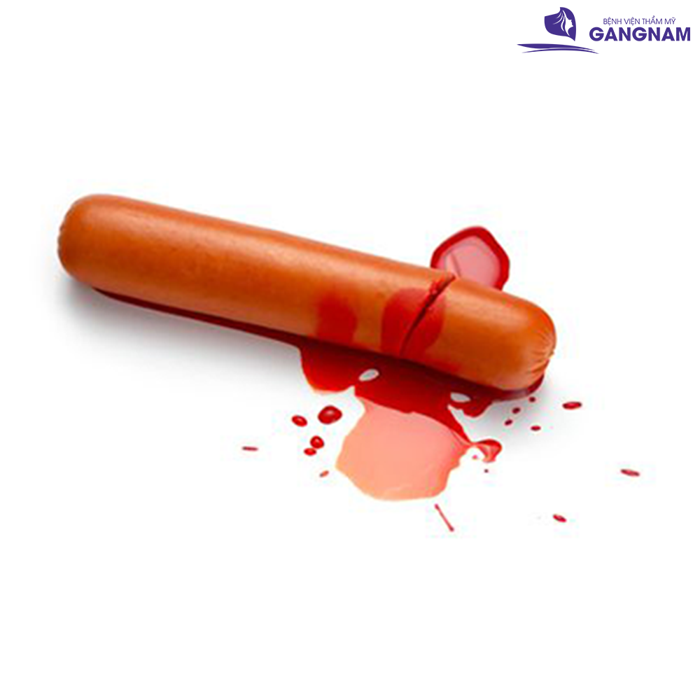 Thực tế về cắt bao quy đầu không đau không chảy máu