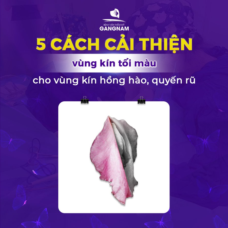 5 cách cải thiện vùng kín tối màu