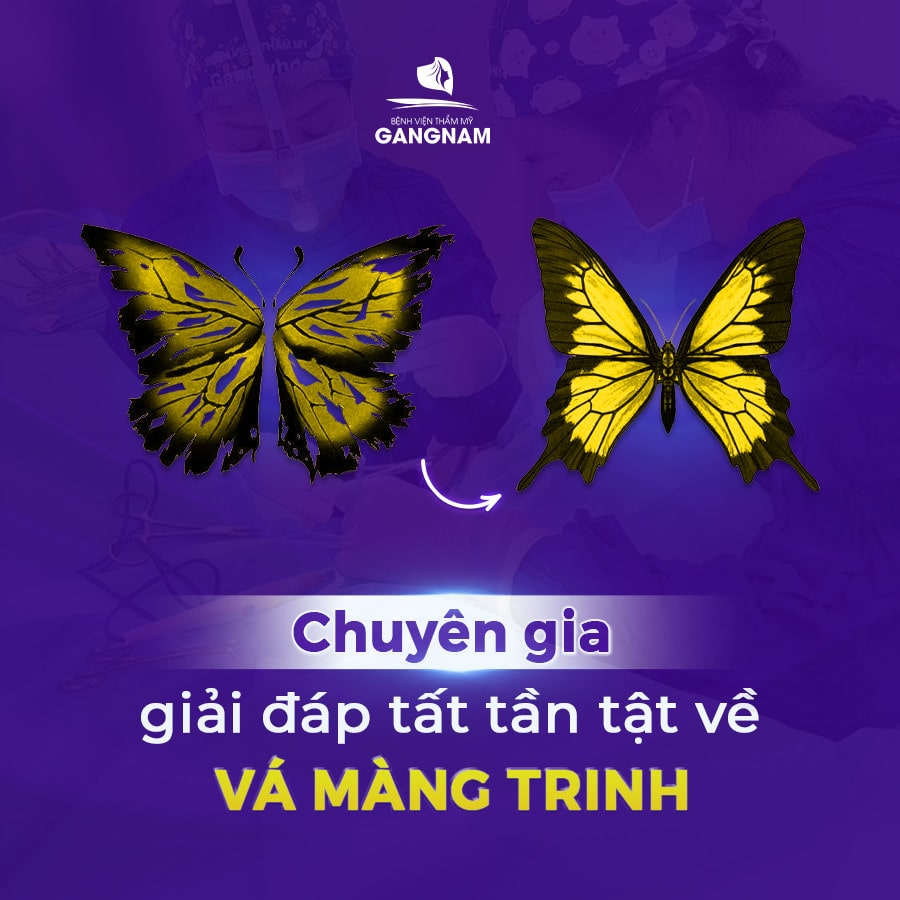 Chuyên gia giải đáp về vá màng trinh