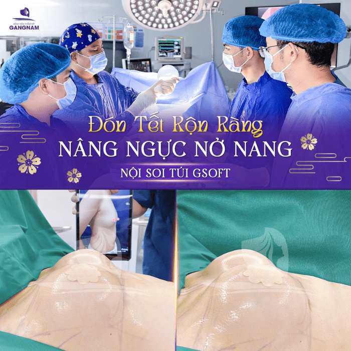 Đón Tết rộn ràng - Nâng ngực nở nang
