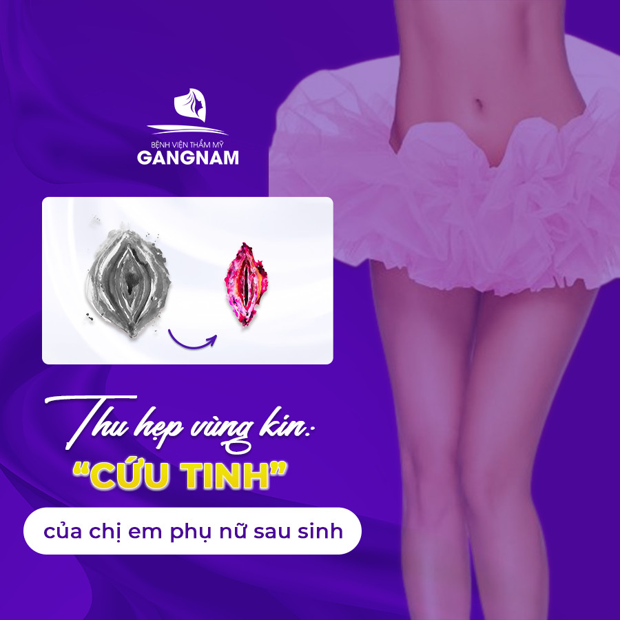 Thu hẹp vùng kín: "cứu tinh" của phụ nữ sau sinh