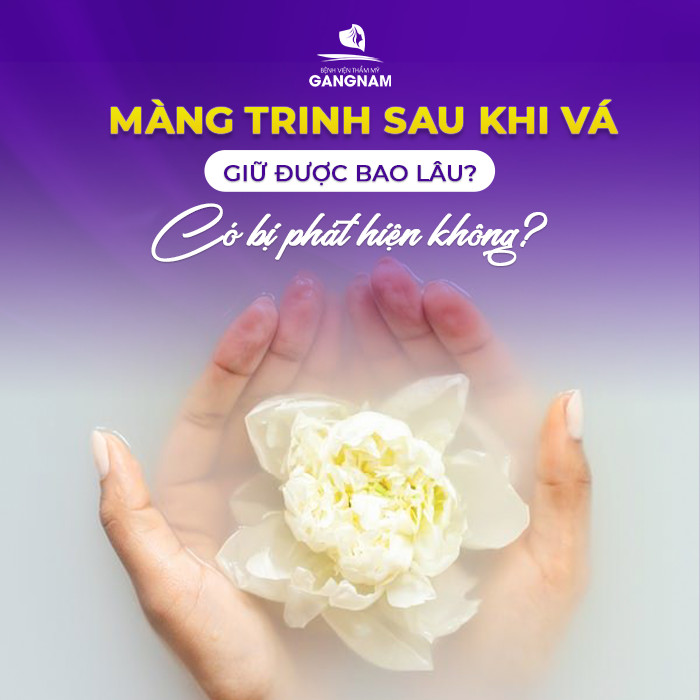 Màng trinh sau vá giữ được bao lâu?