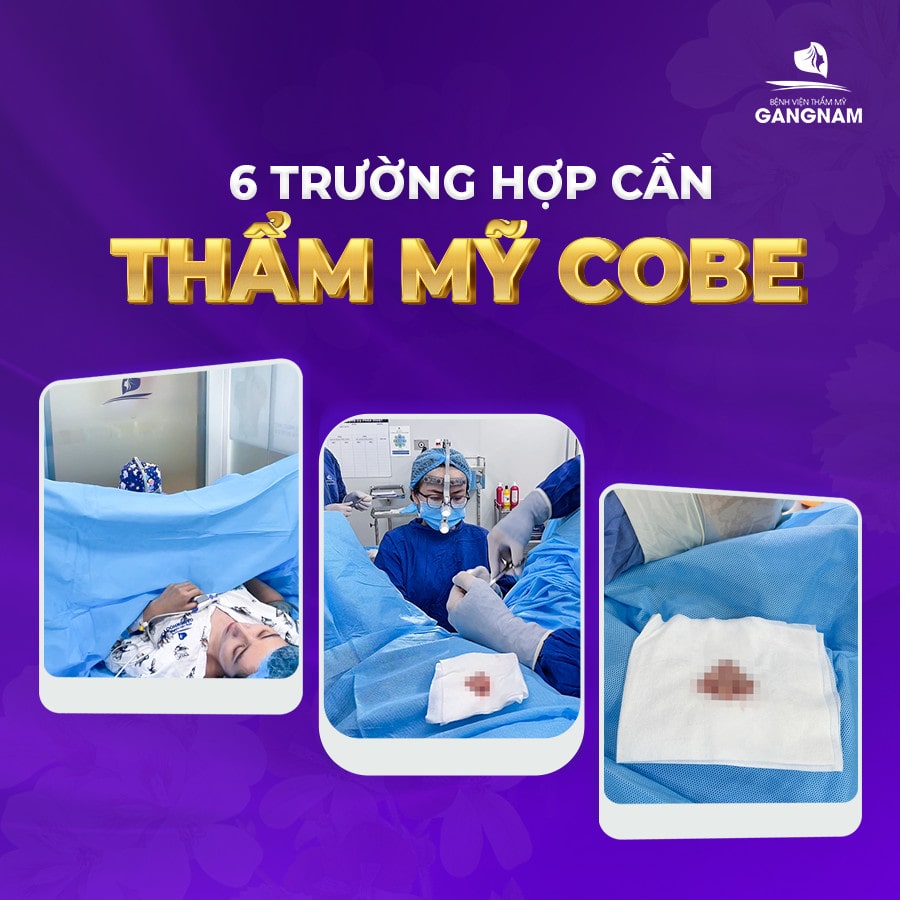 6 trường hợp cần thẩm mỹ vùng kín