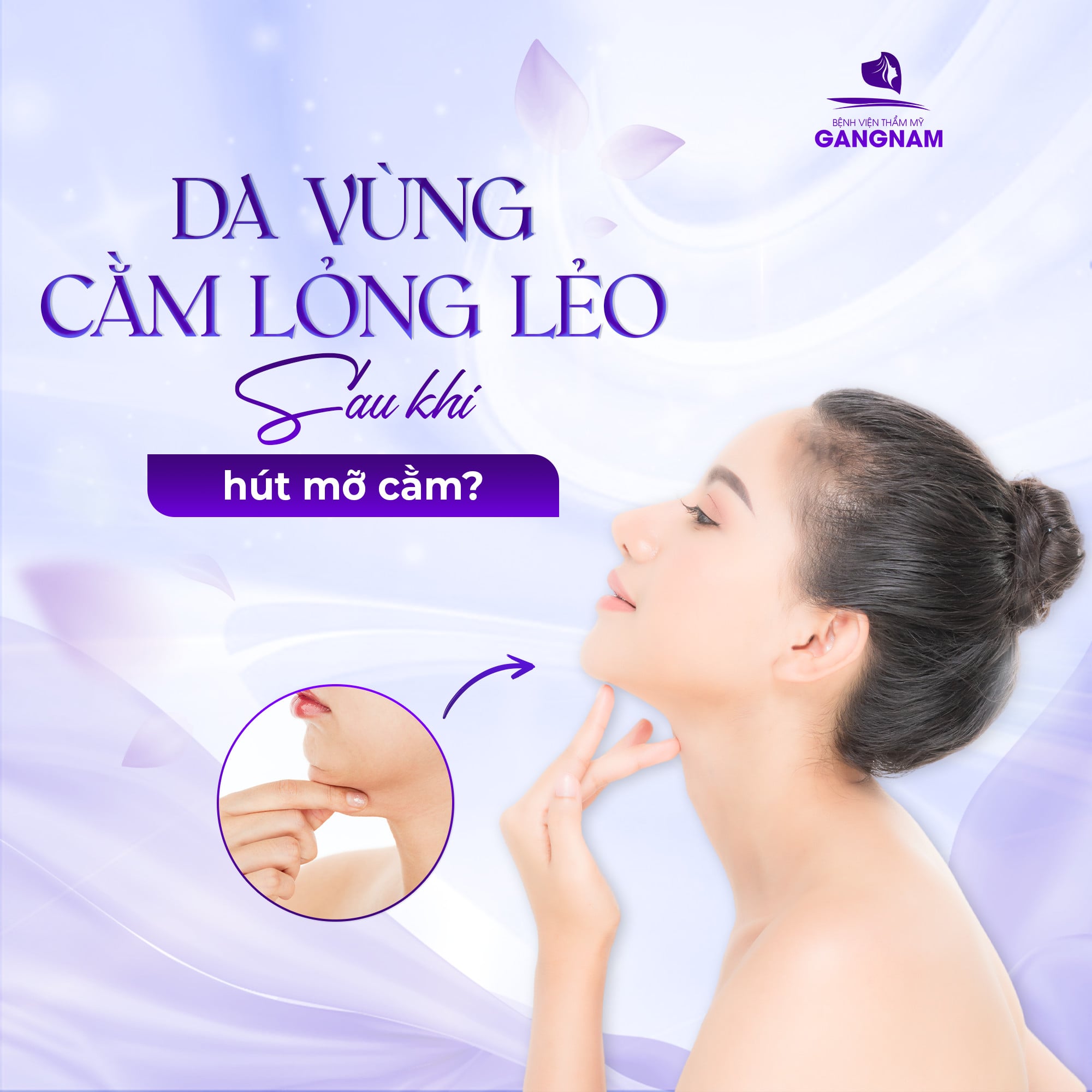 Da lỏng lẻo sau khi hút mỡ nọng cằm