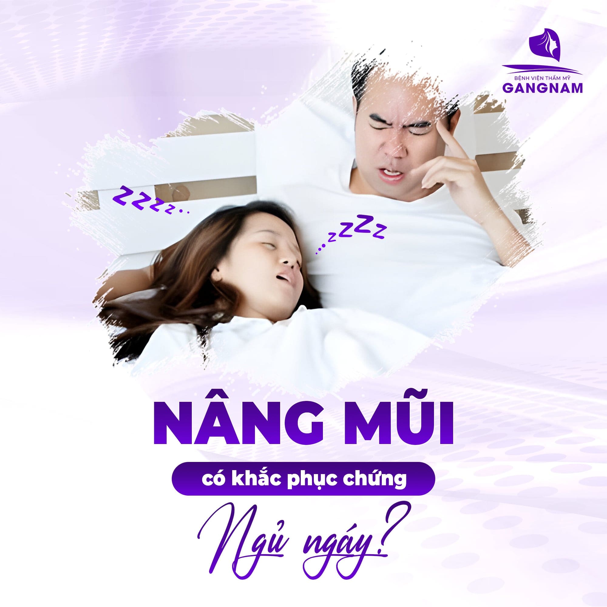 Nâng mũi có chữa được chứng ngủ ngáy?