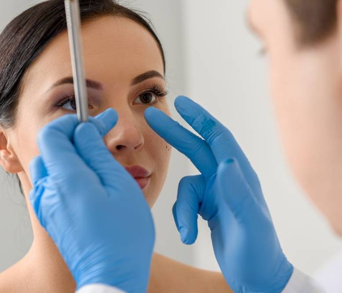 CÓ CẦN NẸP MŨI SAU KHI NÂNG MŨI KHÔNG? GIỮ NẸP TRONG BAO LÂU? 8 CÓ CẦN NẸP MŨI SAU KHI NÂNG MŨI KHÔNG? GIỮ NẸP TRONG BAO LÂU? 7