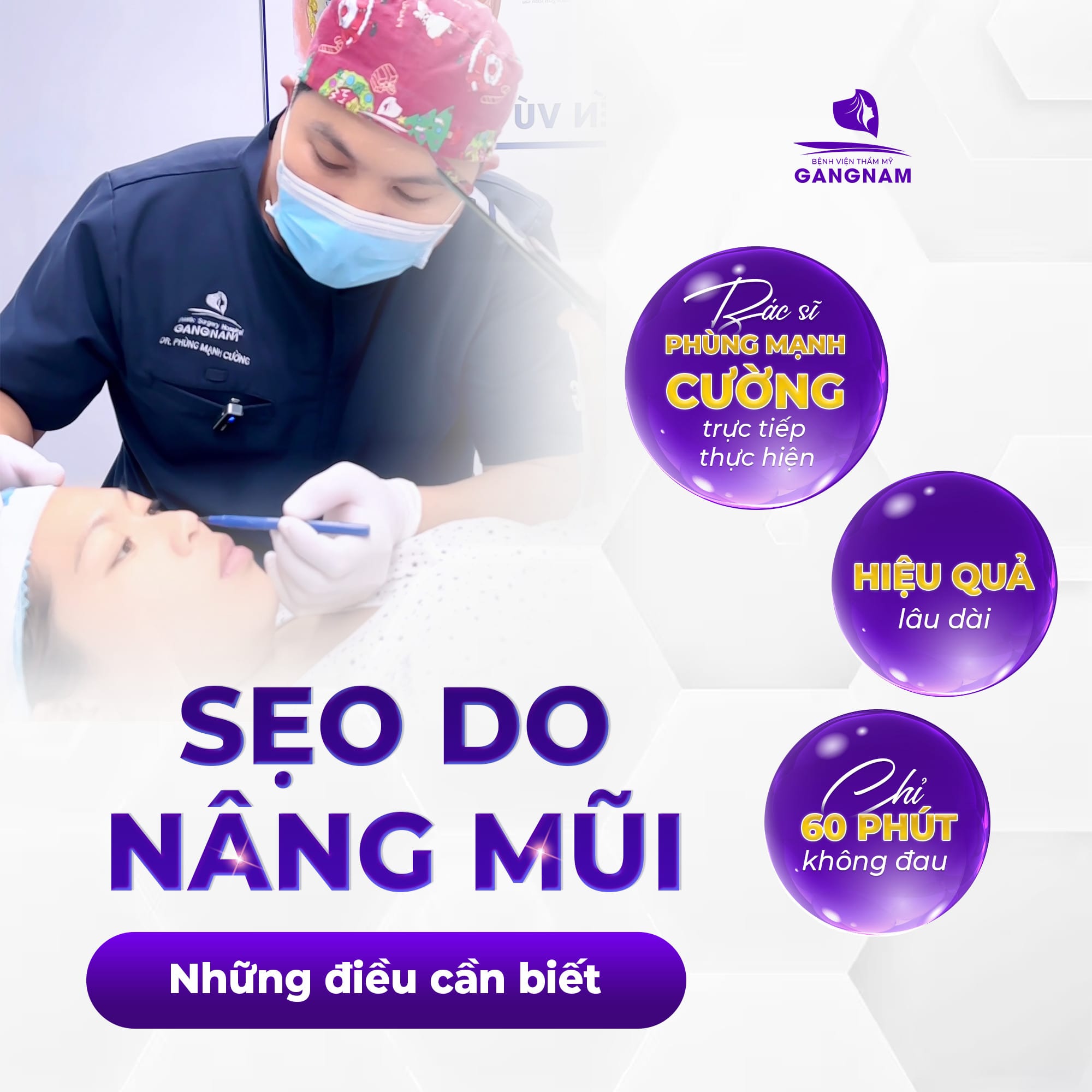 Sẹo do nâng mũi: Những điều cần biết