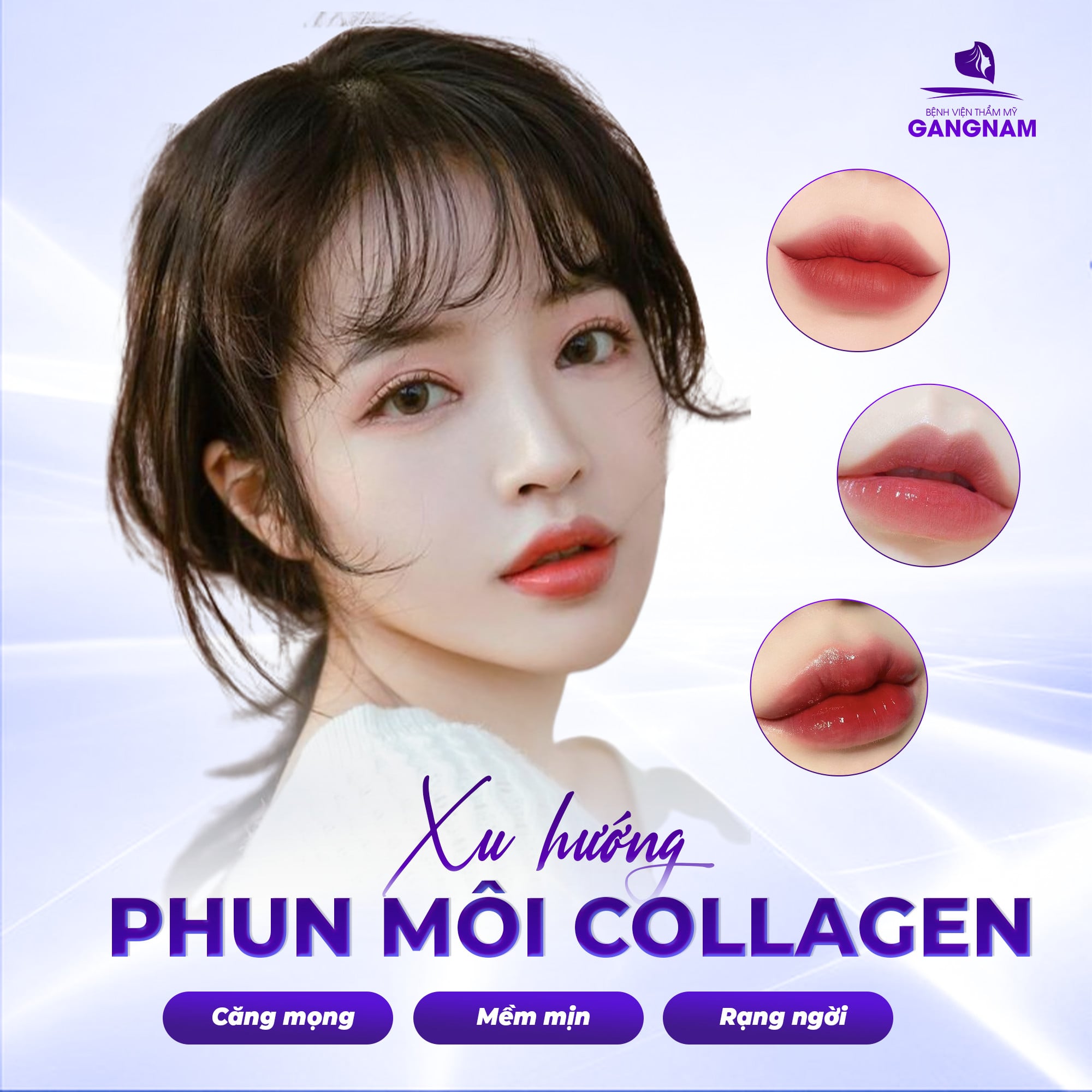 Xu hướng phun môi collagen