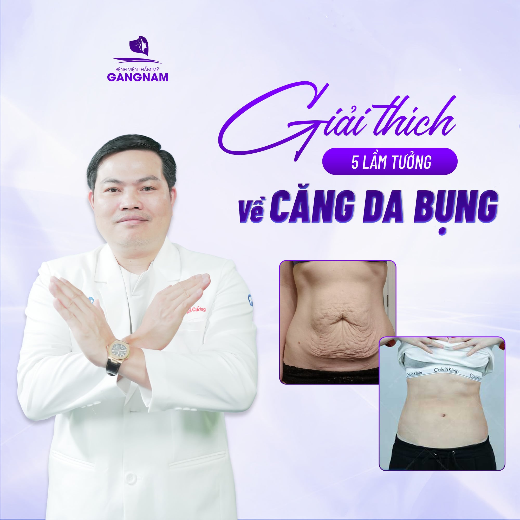 GIẢI THÍCH 5 LẦM TƯỞNG VỀ CĂNG DA BỤNG 6