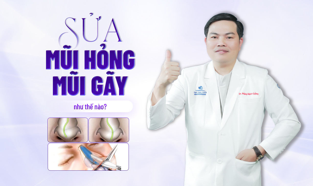 LÀM THẾ NÀO ĐỂ TRÁNH VIỆC SỬA MŨI HỎNG? 1