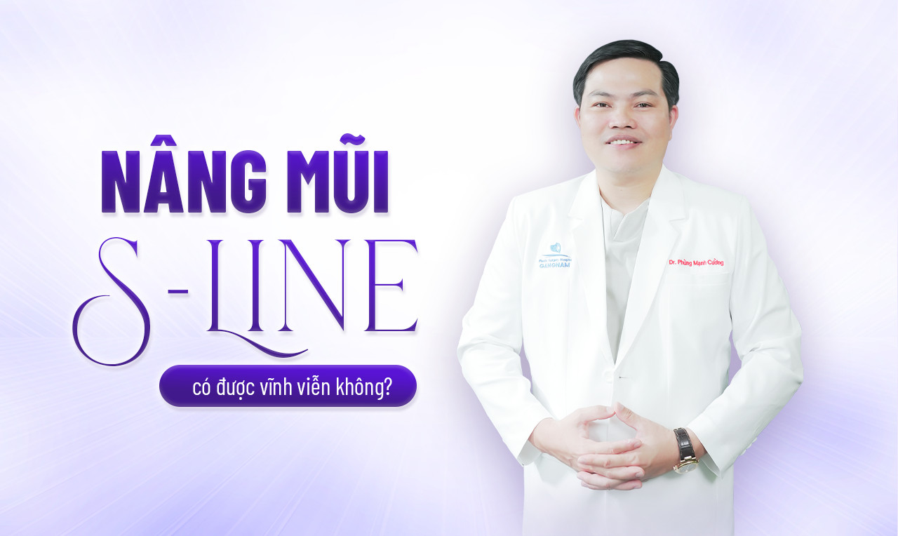 nâng mũi S line có được vĩnh viễn không
