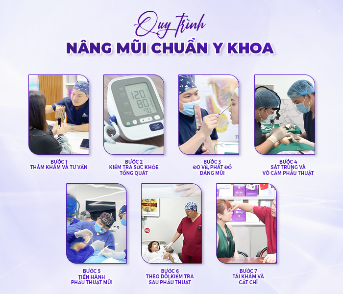 nâng mũi phong thuỷ