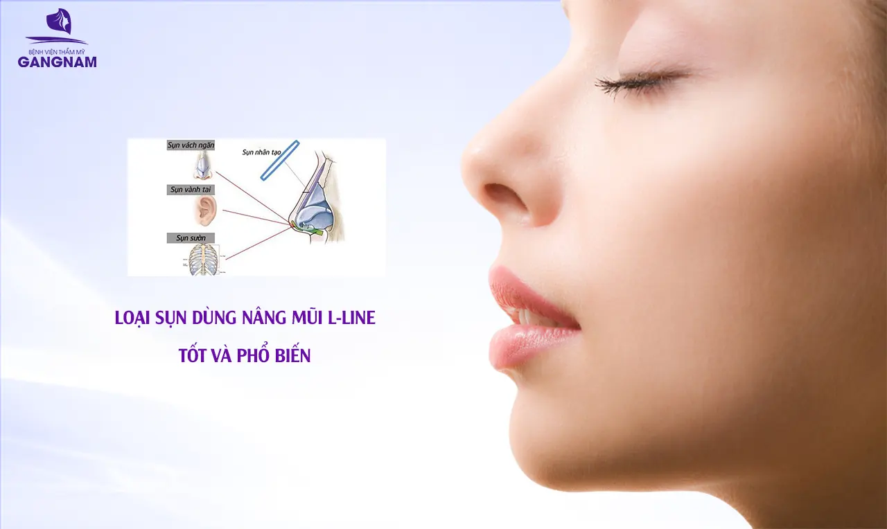 nâng mũi L - Line