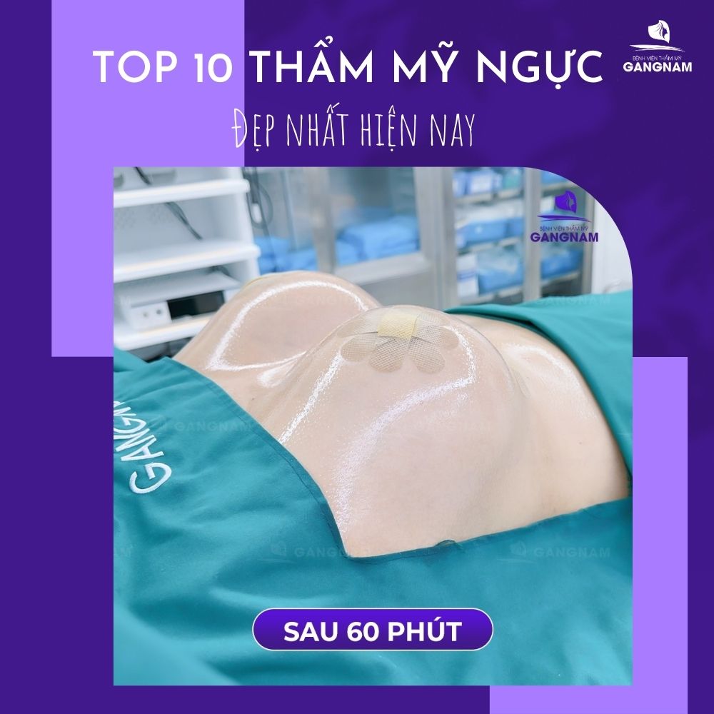 10 Phương pháp phẫu thuật thẩm mỹ ngực đẹp nhất hiện nay