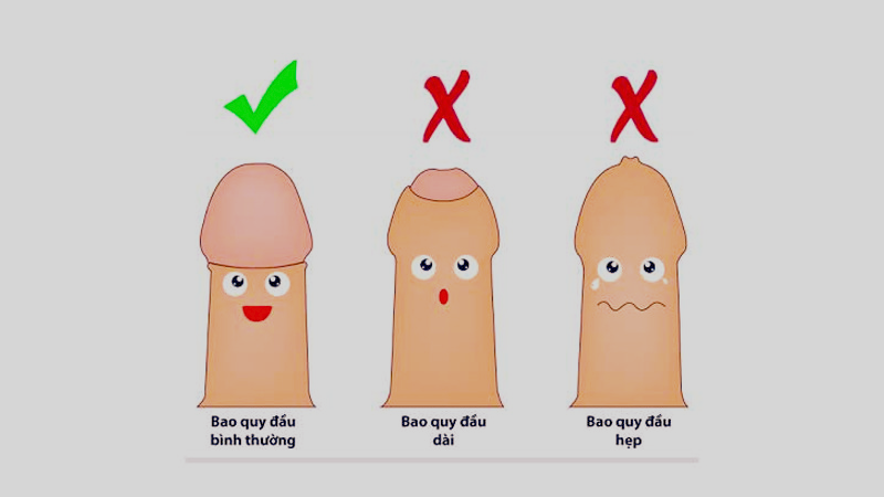 cắt bao quy đầu không khâu