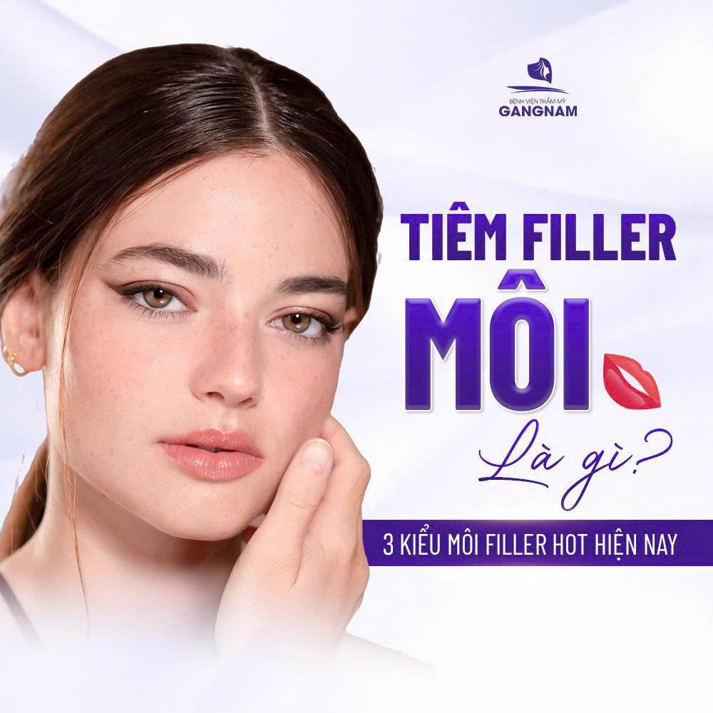 Xu hướng tiêm filler môi hiện nay