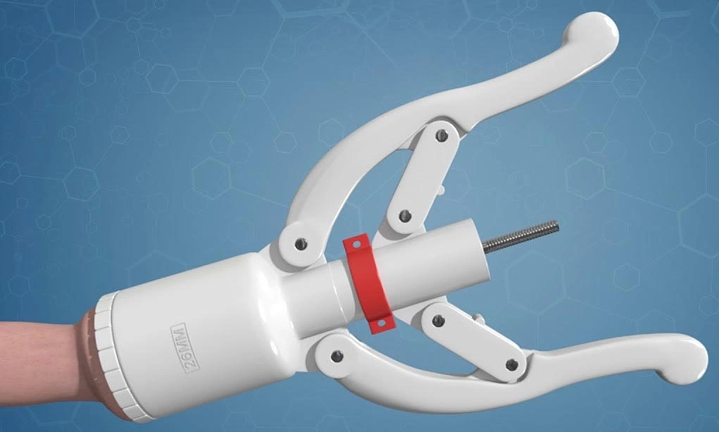 Điều trị hẹp bao quy đầu: Phương pháp và hướng dẫn chi tiết 3