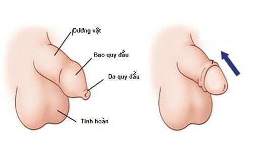 Nong bao quy đầu là gì?