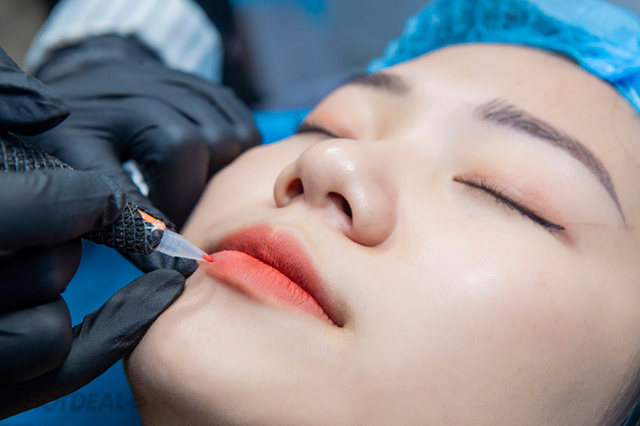 Điều trị thâm môi hiệu quả: Bí quyết để có đôi môi hồng hào tự nhiên 2