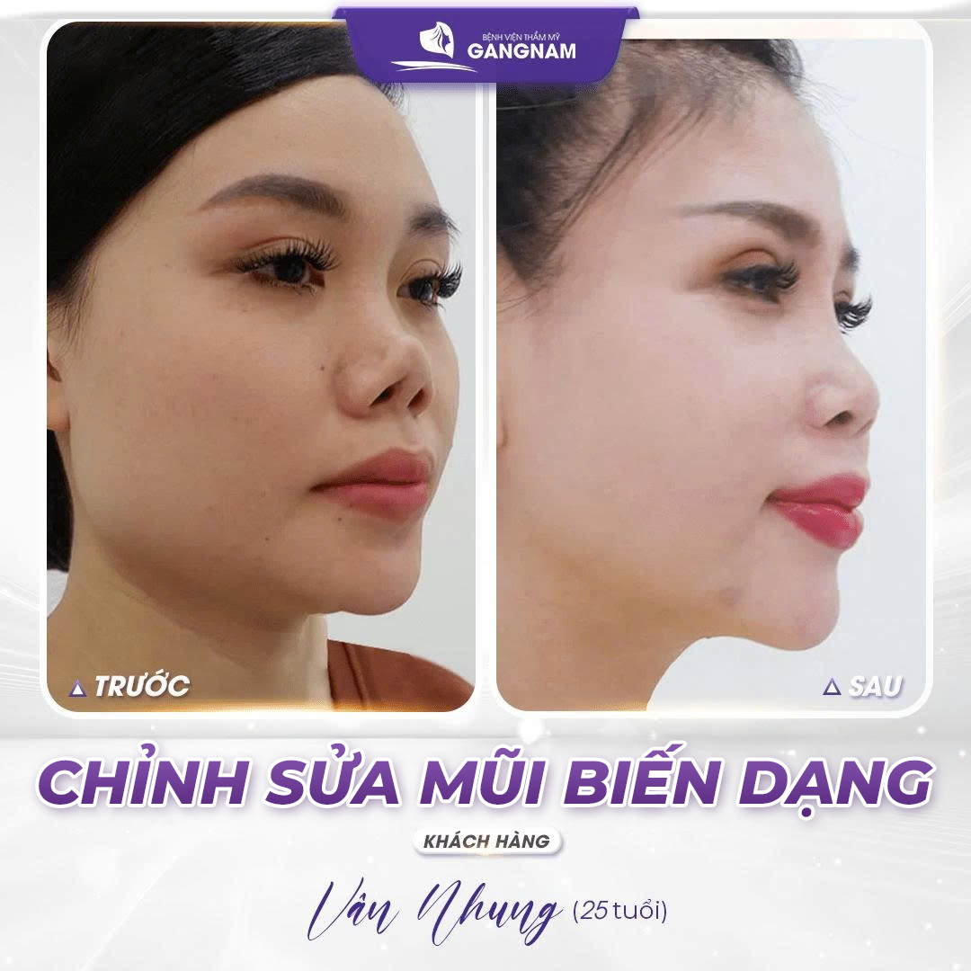 Trang chủ 23
