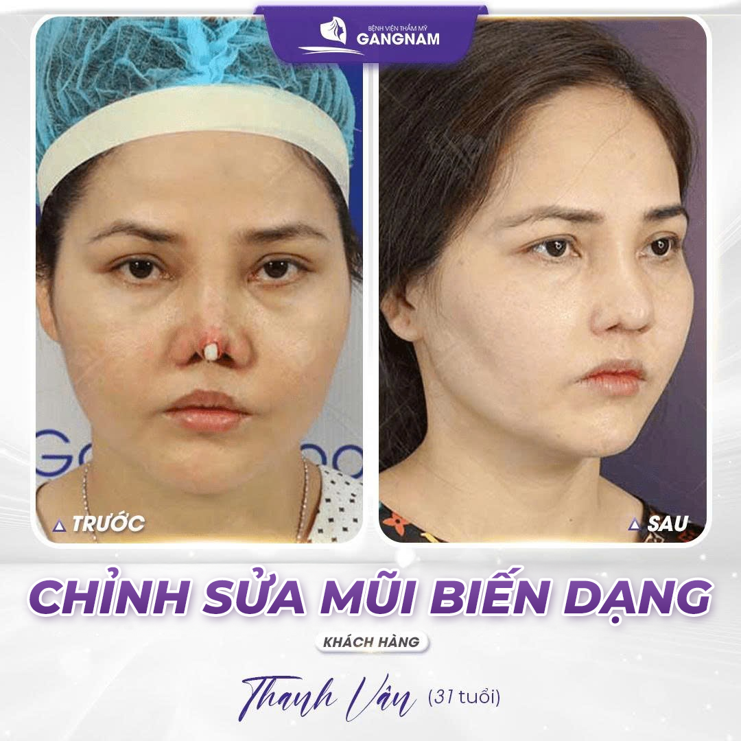 Trang chủ 20