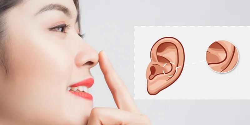 Nâng mũi sụn tự thân - Giải pháp thẩm mỹ an toàn và tự nhiên 2