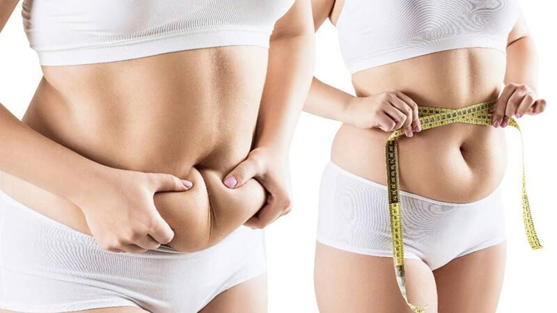 Giảm mỡ vòng 2 bằng phẫu thuật – Giải pháp nhanh chóng và hiệu quả