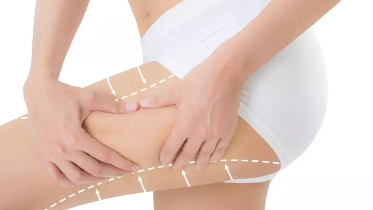 Giảm mỡ đùi: Bí quyết để có đôi chân thon gọn và săn chắc 4 Tầm quan trọng của việc giảm mỡ đùi