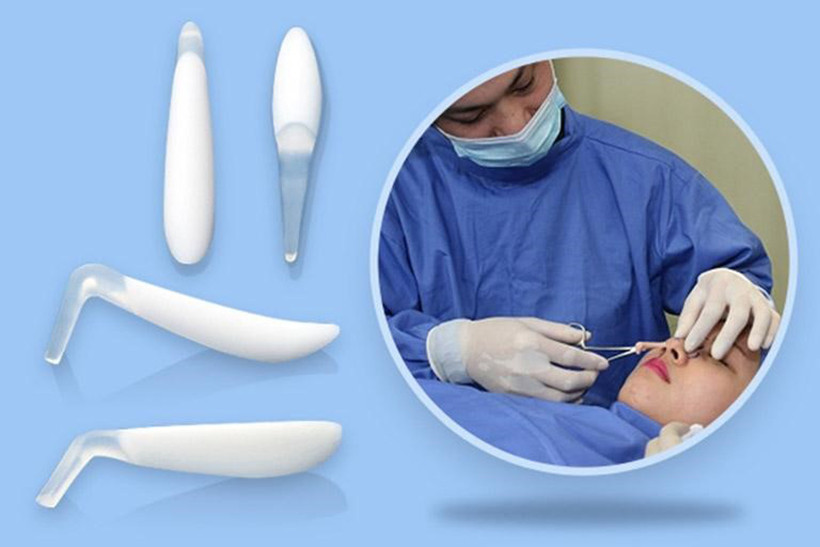 Nâng mũi Nanoform - Giải pháp thẩm mỹ mũi hiện đại và an toàn 1