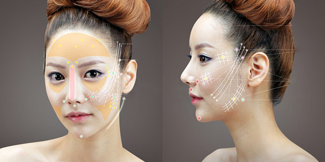 Căng da mặt bằng chỉ: Giải pháp làm đẹp không phẫu thuật 4 Căng da mặt bằng chỉ là gì
