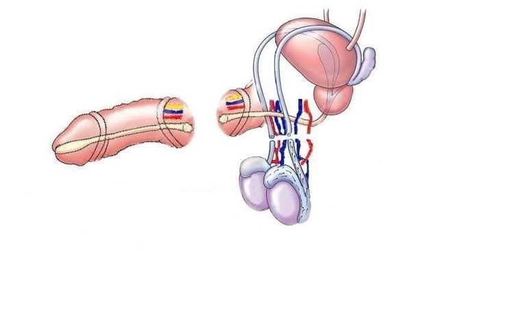 Sơ cứu ban đầu khi gặp rách tĩnh mạch dương vật