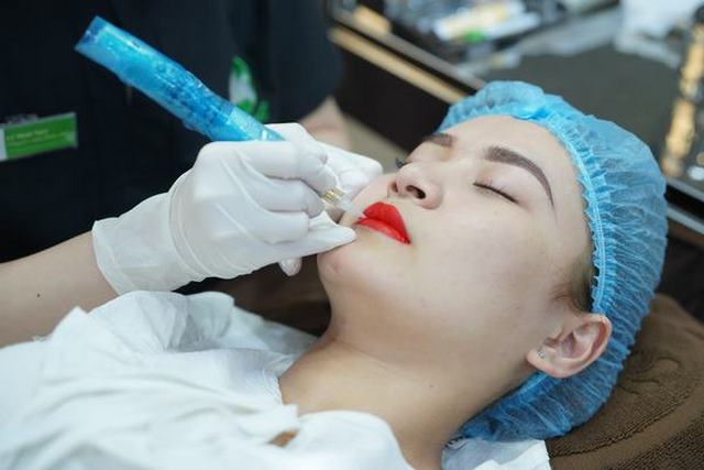 Công nghệ plasma trong làm hồng môi công nghệ cao