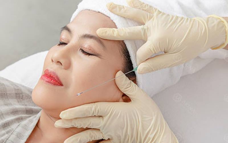 Căng da mặt bằng chỉ: Giải pháp làm đẹp không phẫu thuật 5 Căng da mặt bằng chỉ có đau không?