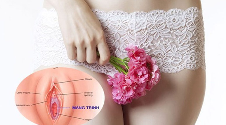 Lý do phụ nữ lựa chọn phẫu thuật vá màng trinh