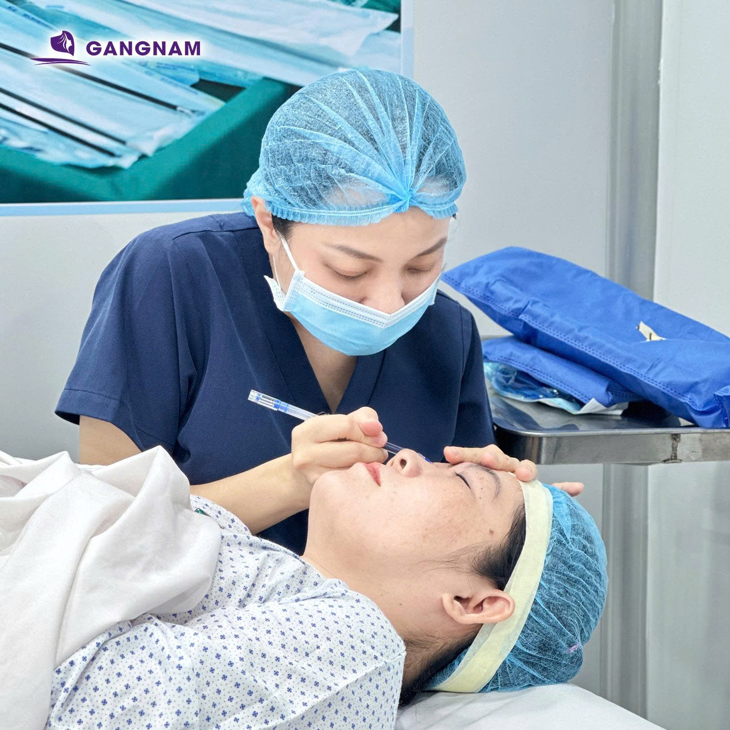 Quy trình bấm mí không sẹo
