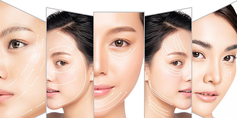 Nâng cơ mặt Deep SMAS – Bí quyết trẻ hóa khuôn mặt tự nhiên 4