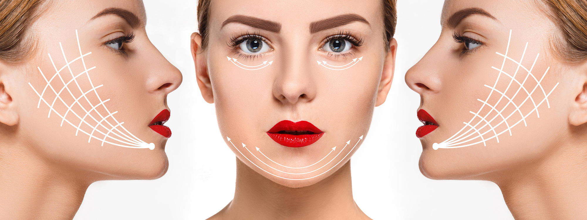 Đối tượng phù hợp với căng da mặt công nghệ RF Laser