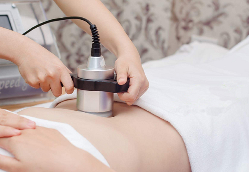 Giảm mỡ không phẫu thuật: Giải pháp thẩm mỹ hiện đại cho vóc dáng thon gọn 4 Tổng quan về giảm mỡ không phẫu thuật