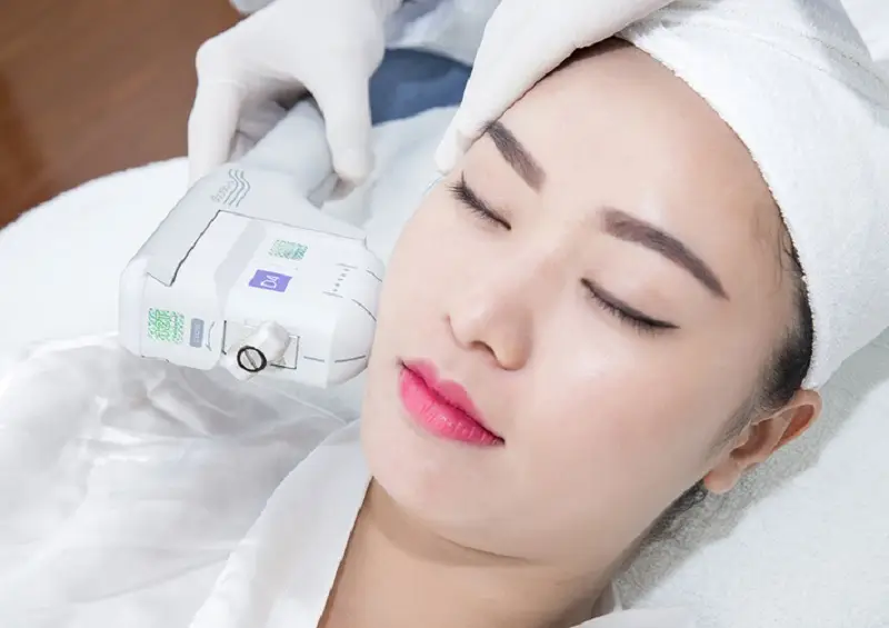 Căng da mặt công nghệ RF Laser là gì?