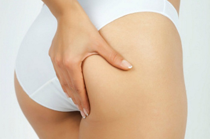 Tạo hình mông - Bí quyết sở hữu vòng 3 căng tròn, quyến rũ 4 Tạo hình mông là gì?