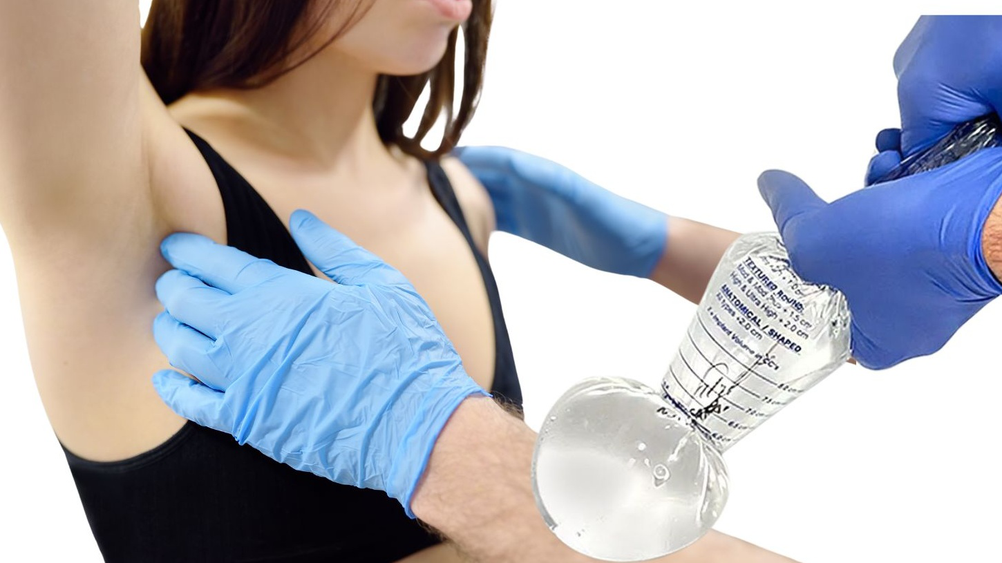 Nâng ngực 6D hạn chế sẹo - Giải pháp thẩm mỹ hiện đại 5 Ai phù hợp với nâng ngực 6D hạn chế sẹo?