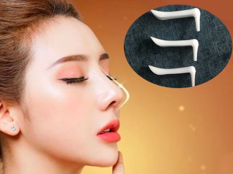 Nâng mũi bằng sụn nhân tạo: Giải pháp thẩm mỹ an toàn và hiệu quả 1