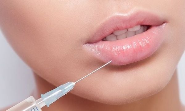 Tiêm Filler Tạo Hình Đôi Môi: Phương Pháp Thẩm Mỹ An Toàn Và Hiệu Quả 2