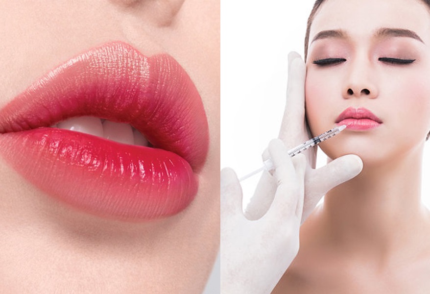 Tạo khóe môi cười: Bí quyết cho nụ cười rạng rỡ 3