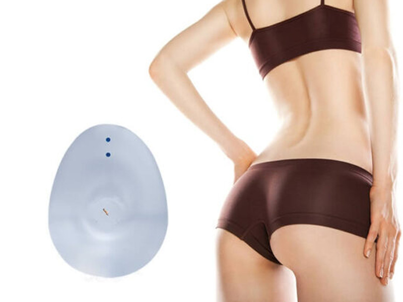 Nâng mông nội soi Nano Chip - Giải pháp thẩm mỹ hiện đại 4 Nâng mông nội soi Nano Chip là gì?