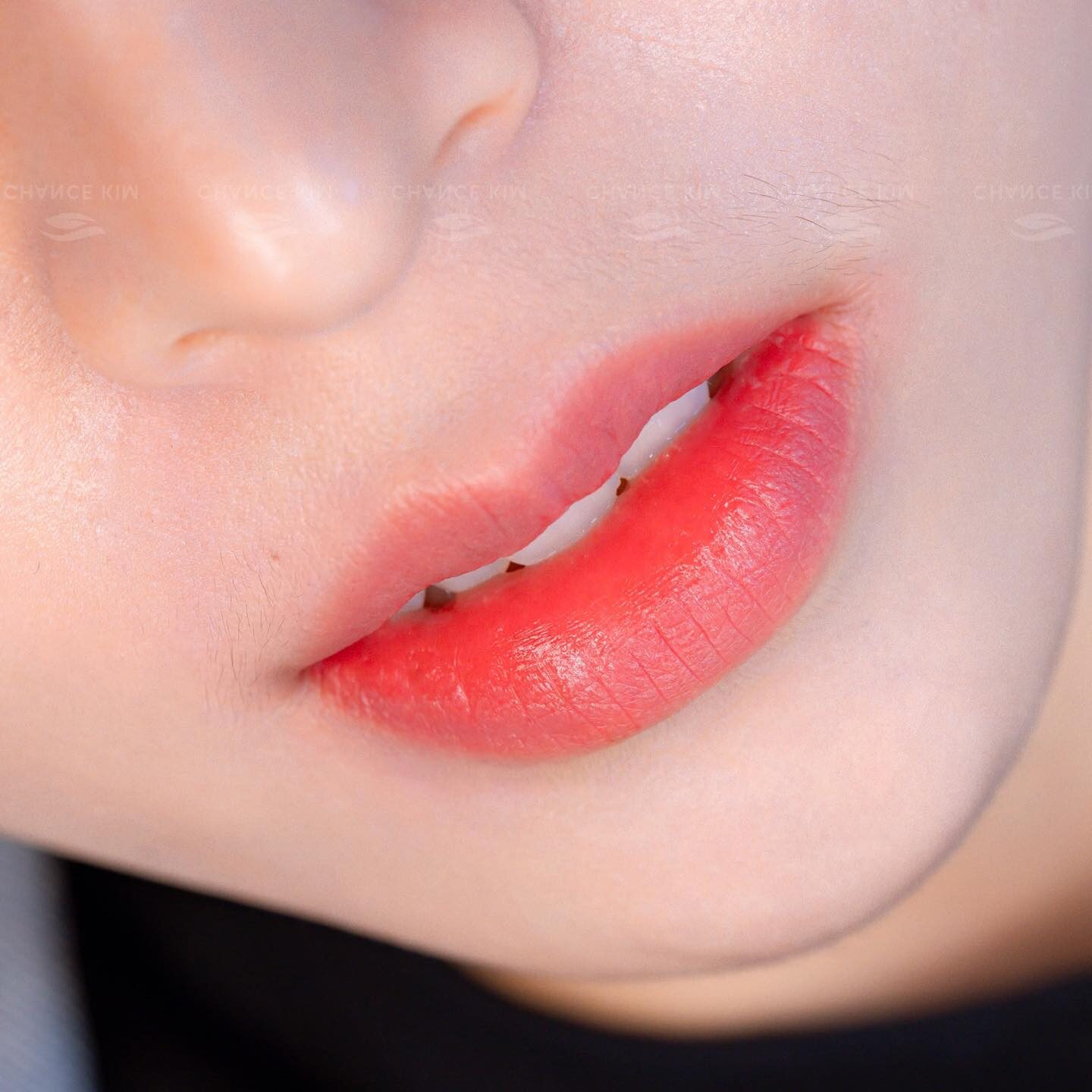 Phun môi collagen căng mọng – Bí quyết sở đẹp, sở hữu đôi môi đẹp tự nhiên 2