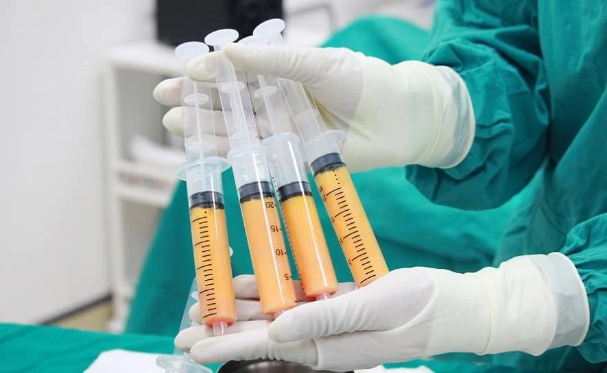 Nâng ngực bằng mỡ tự thân an toàn: Giải pháp thẩm mỹ tự nhiên và hiệu quả 5 Quy trình thực hiện nâng ngực bằng mỡ tự thân an toàn