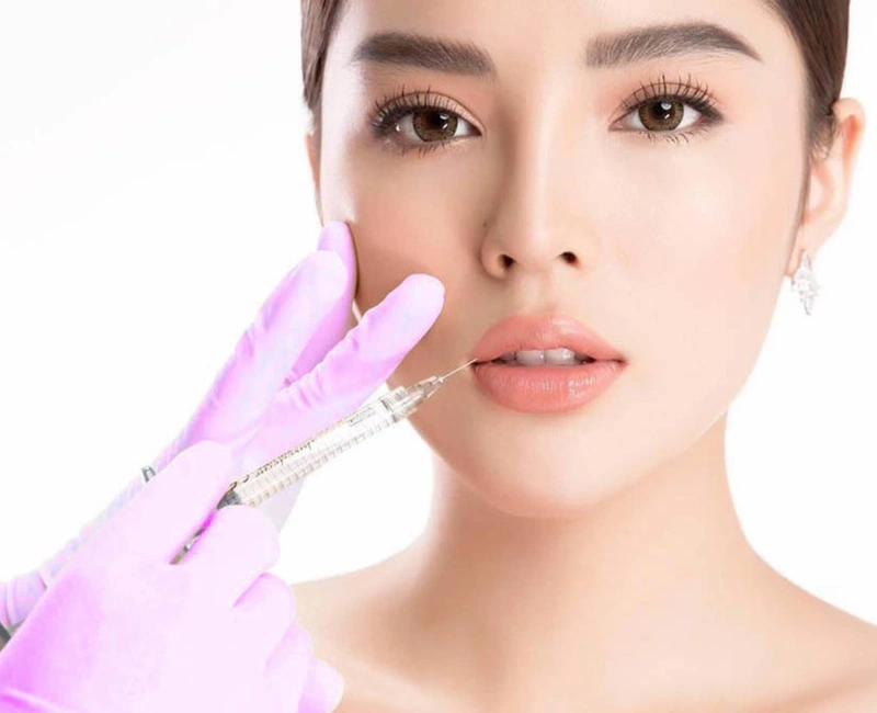 Tiêm filler làm hồng môi: Bí quyết sở hữu đôi môi căng mọng hồng hào tự nhiên 1